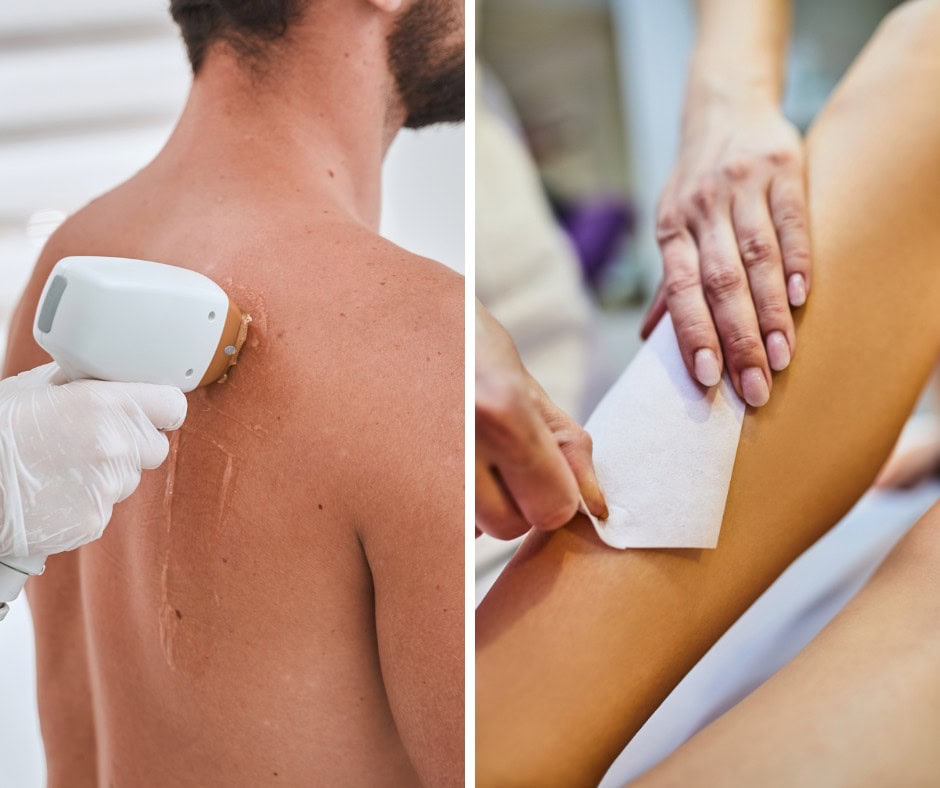 Safe laser hair removal treatment at Luxe Laser Lounge & Boutique, providing smooth, hair-free skin.