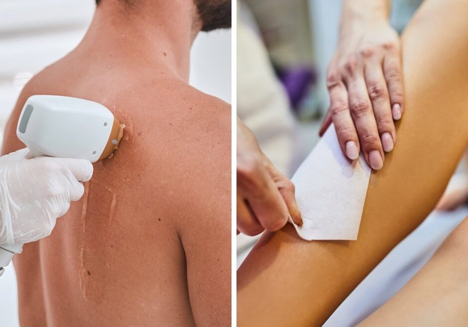 Untitled design (4) Safe laser hair removal treatment at Luxe Laser Lounge & Boutique, providing smooth, hair-free skin.
